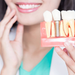 implant-tedavisi-izmir-karsiyaka